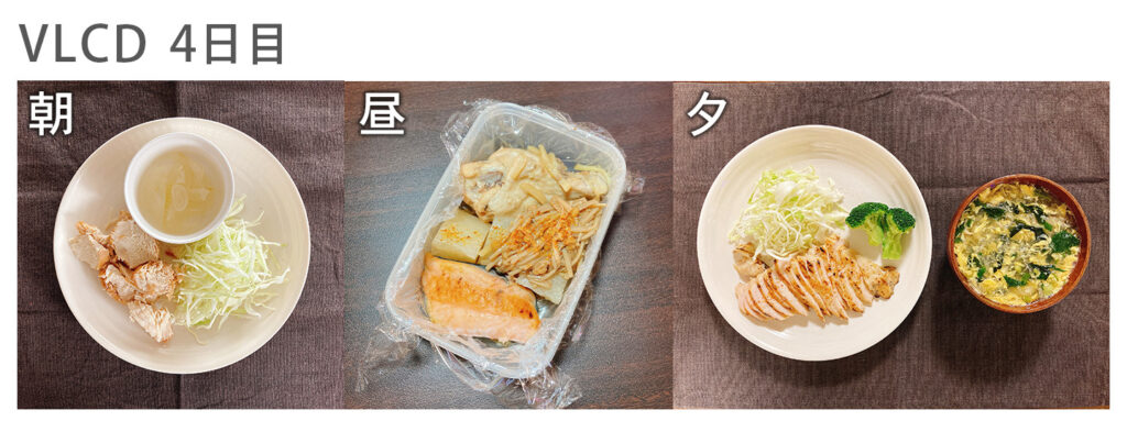 VLCDダイエットでの食事プランのポイント - VLCDダイエットのデメリット